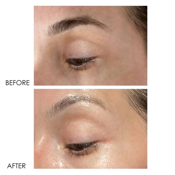 dERmELCT Eyelid & Dark Circle Corrector Professional Strength - Picture 11 of 15